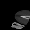 SPORK, NICO - 22.03.1976 - 02.08.2022 - CT obere Extremität - 17:51:17